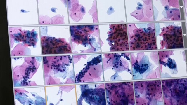 Medipath Rch Medipath : dans les coulisses du dépistage du cancer